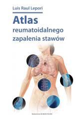 Atlas reumatoidalnego zapalenia stawów (1)