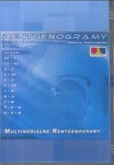 Program - Rentgenogramy CD-ROM (1)
