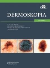 Dermoskopia (1)